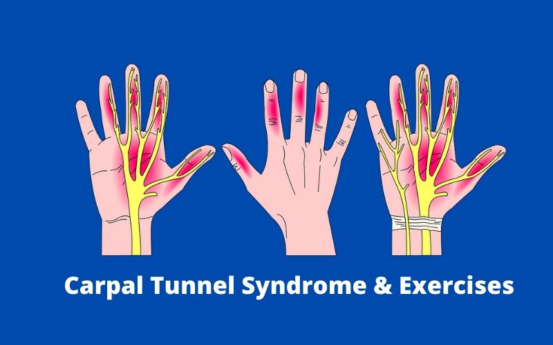 Carpal Tunnel Syndrome & Exercises (3)