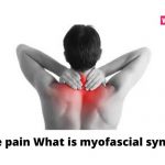 Muscle pain What is myofascial syndrome