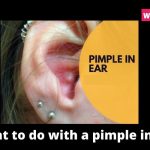 What to do with a pimple in ear