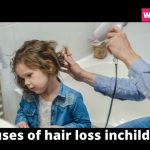causes of hair loss inchildren