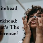 Whitehead VS Blackhead