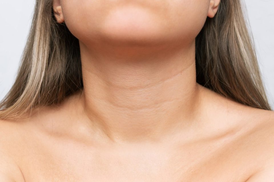 how to get rid of neck wrinkles
